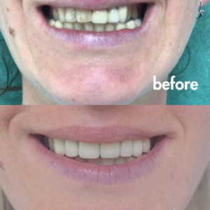 Beige Minimalist Beauty Before After Collage Instagram Post (1)